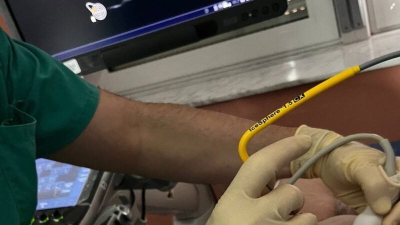 El Hospital La Candelaria aplica crioablación en cáncer de mama